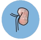 腎臓病の進行ステージ3